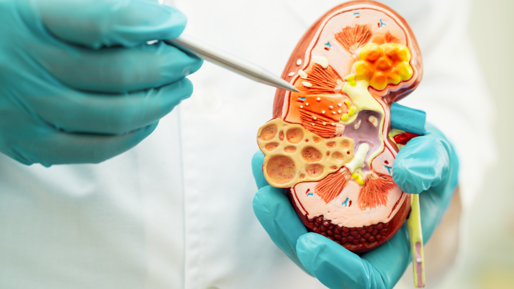 Person holding lower back indicating kidney pain symptoms.