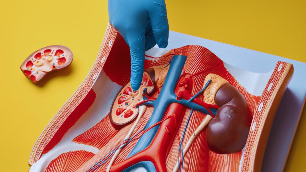Kidney Stones Treatment: Complex Management Protocols