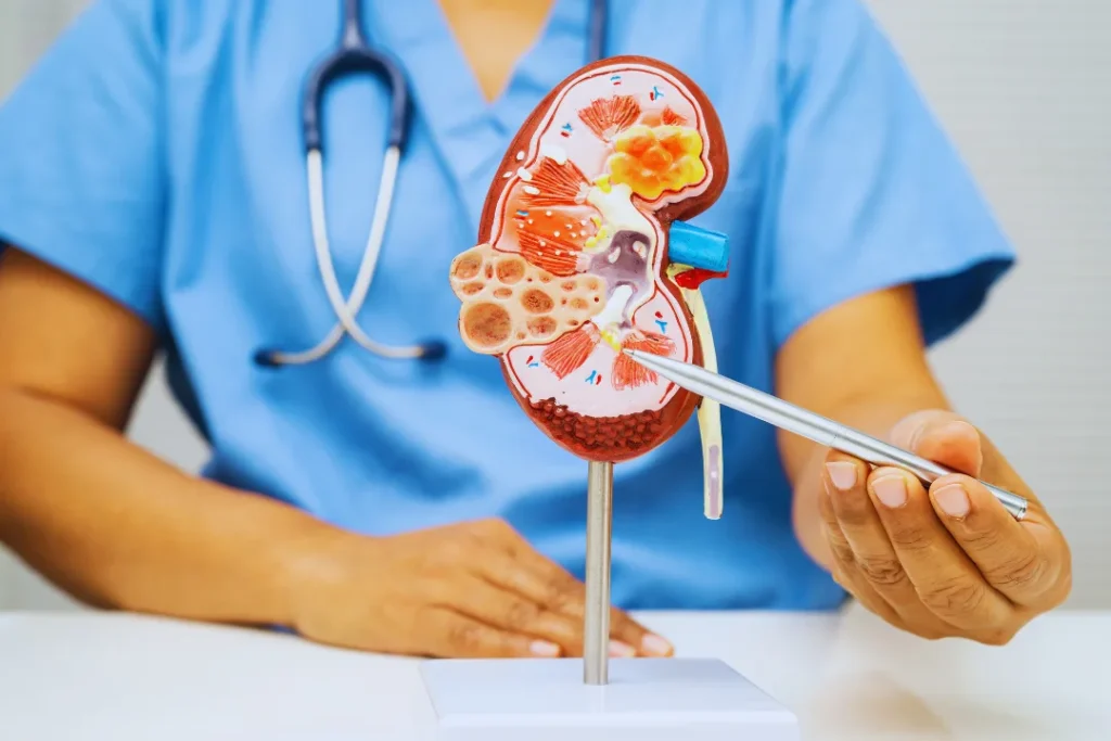 Doctor explaining kidney stone treatment with a kidney model
