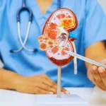 Doctor explaining kidney stone treatment with a kidney model